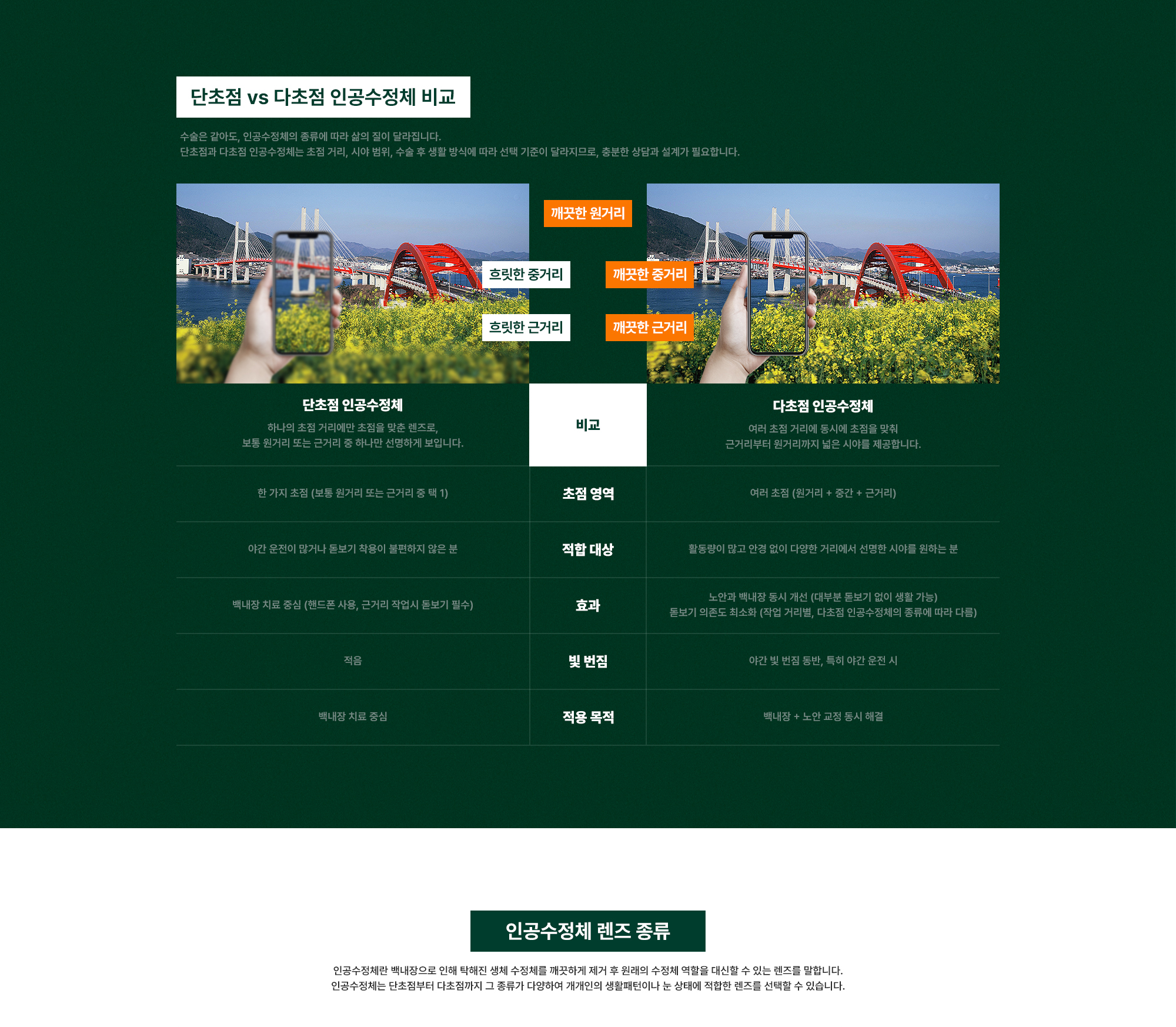 노안 인공수정체 맞춤 컨설팅